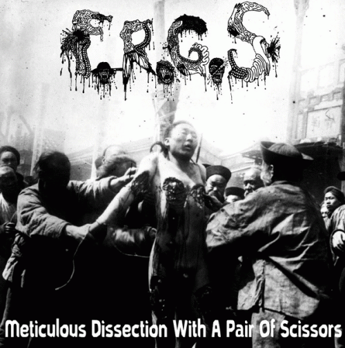 Festering Recto Gangrenous Slime : Meticulous Dissection with a Pair of Scissors